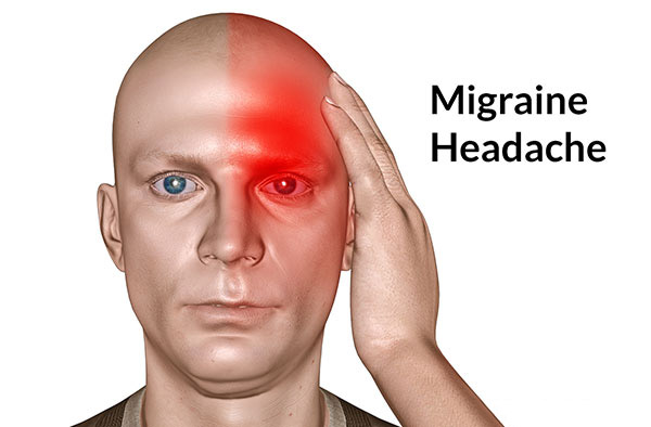 Nguyên nhân gây đau nửa đầu thường gặp ở phụ nữ