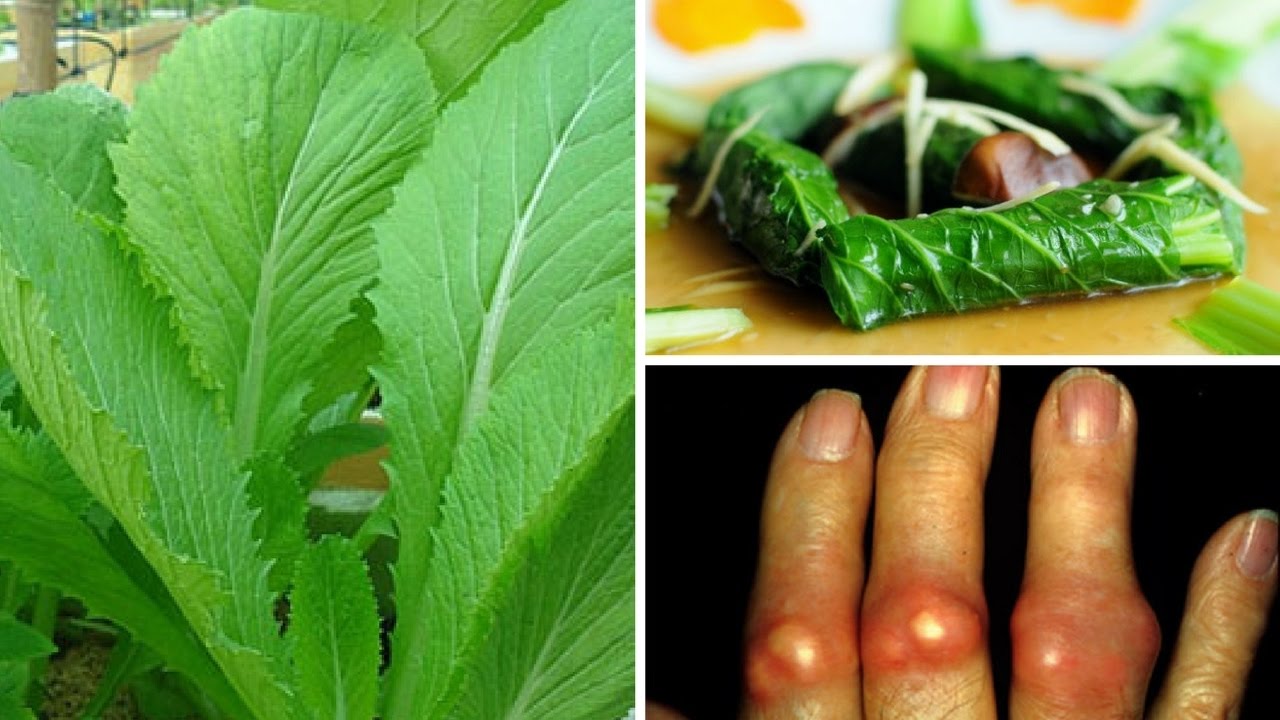 Các bài thuốc dân gian giúp đẩy lùi bệnh gút Các bài thuốc dân gian giúp đẩy lùi bệnh gút